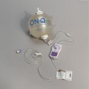 ON-Q pump